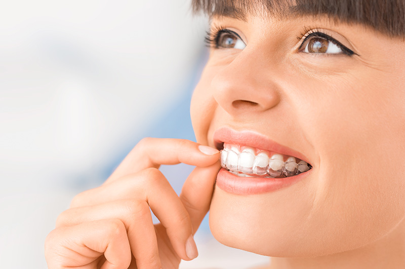 Invisalign in Dallas