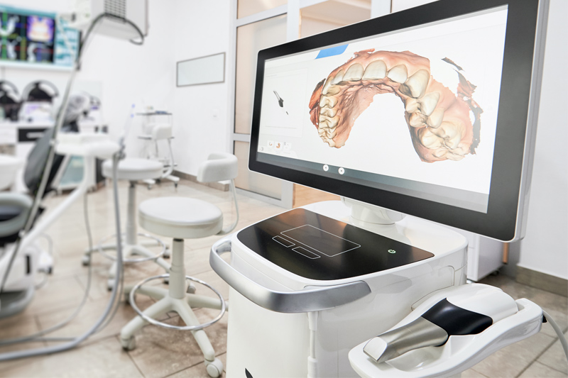 Intra-Oral Scanner in Dallas